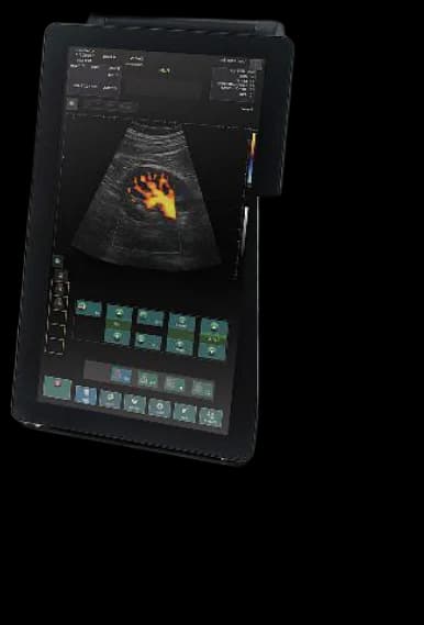 ALBIT Simple & Smart tablet scanner