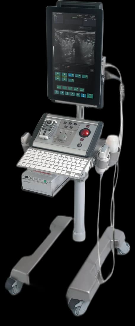 ALBIT ultrasound scanner on its trolley